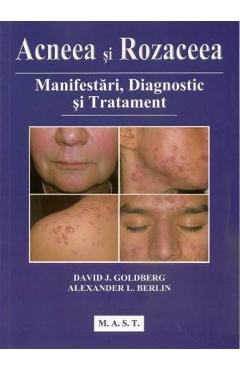 Carte Acneea si rozaceea - David J. Goldberg editura David J. Goldberg
