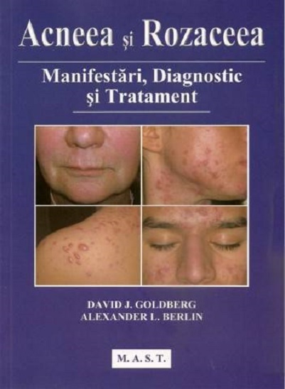 Carte Acneea si rozaceea autor David J. Goldberg