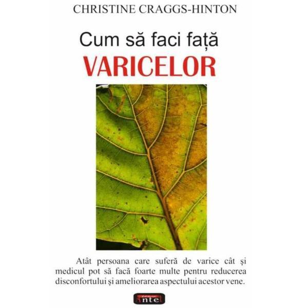 Carte Cum sa faci fata varicelor - Christine Craggs-Hinton