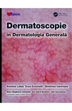 Carte Dermatoscopie in Dermatologia Generala - Aimilios Lallas