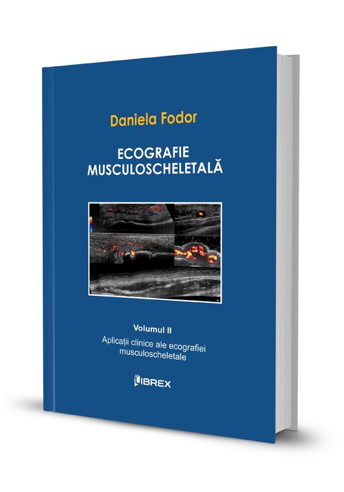 Carte Ecografie musculoscheletală - Daniela Fodor - Vol. II editura Librex Publishing